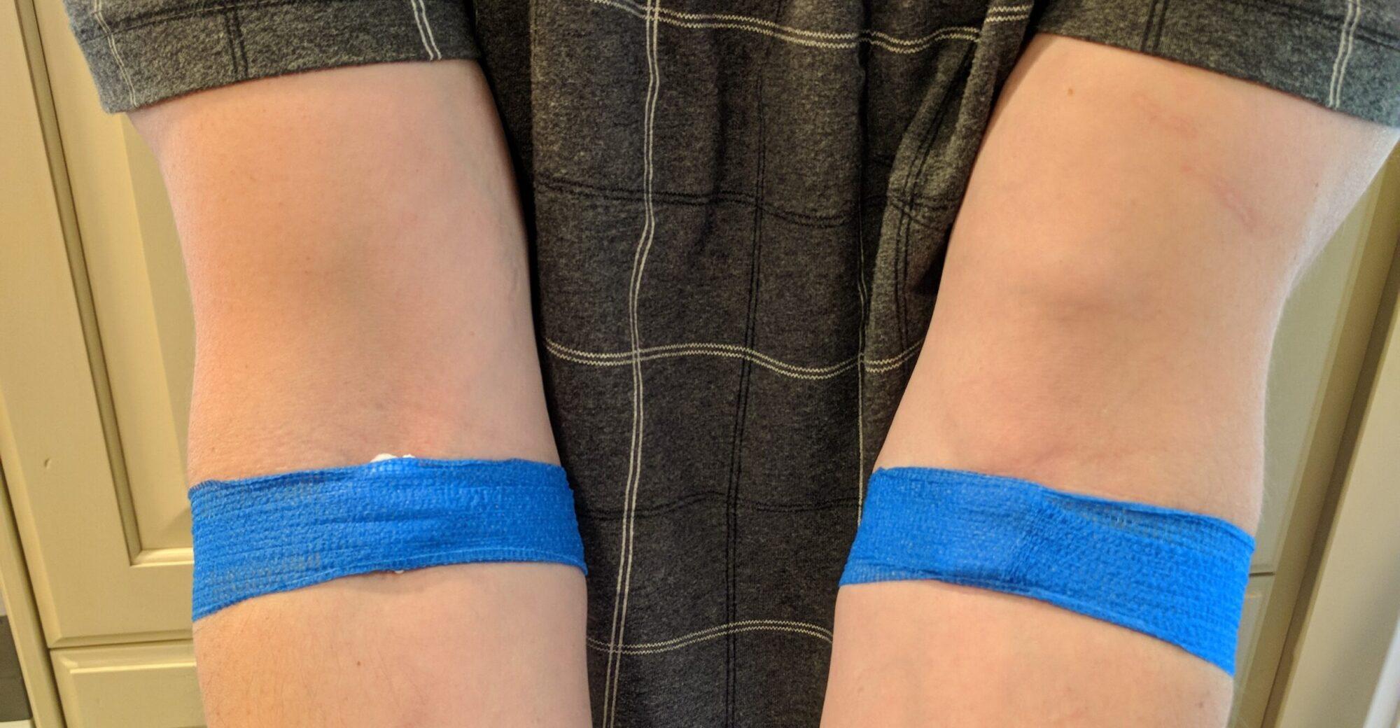 blood donation